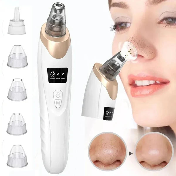 Rechargeable Blackhead Remover Vacuum - Pore Cleaner with 5 Suction Heads